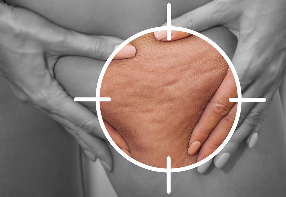 cellulite massage amincissant